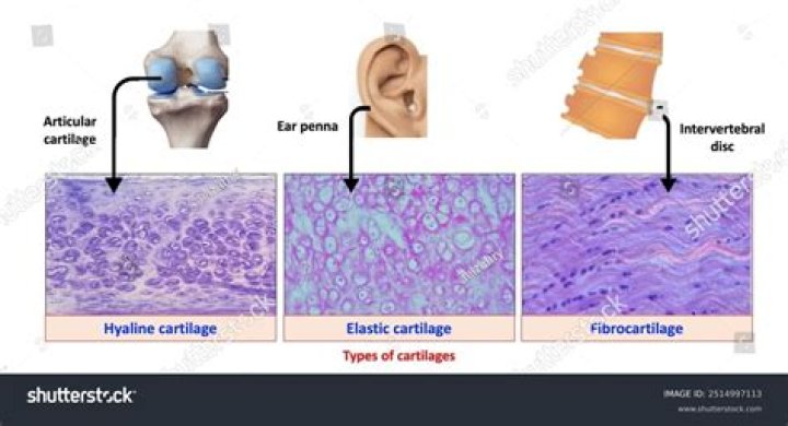 Are hyaline cartilage and articular cartilage the same?